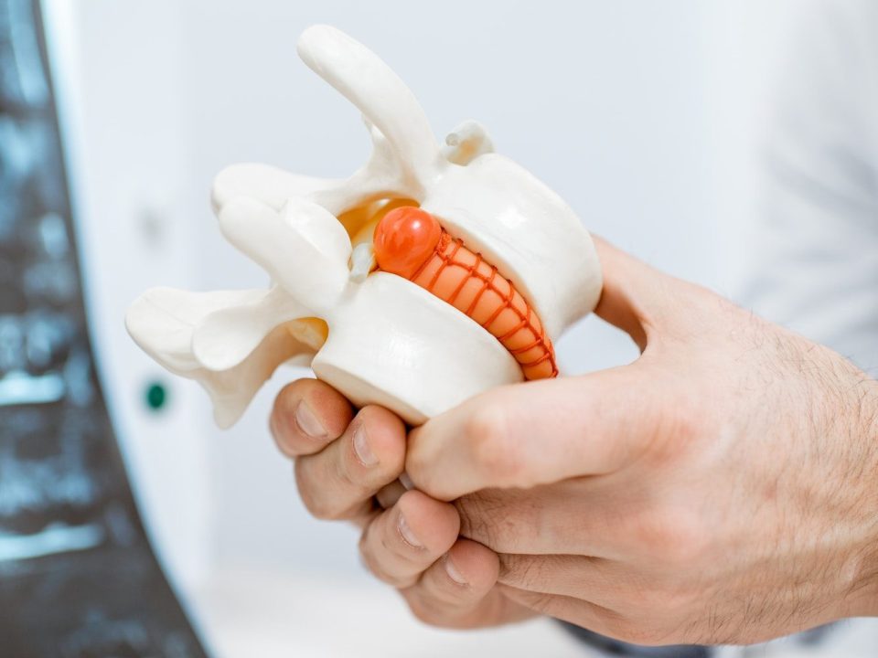 Les Pathologies Discales De La Colonne Cervicale (Cou): Bombement Discal, Pincement Discal, Hernie Discale Ou Protrusion Discale Et Leurs Traitements Clinique Tagmed Montréal Terrebonne