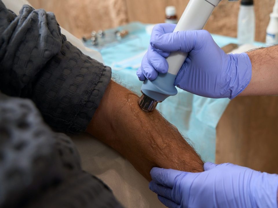 Tendinite Calcifiée Clinique Tagmed Montréal Terrebonne