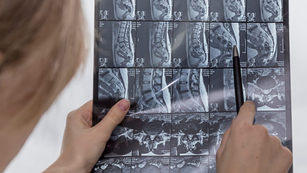 Traitement De La Hernie Discale À Bois-Des-Filion Clinique Tagmed Montréal Terrebonne