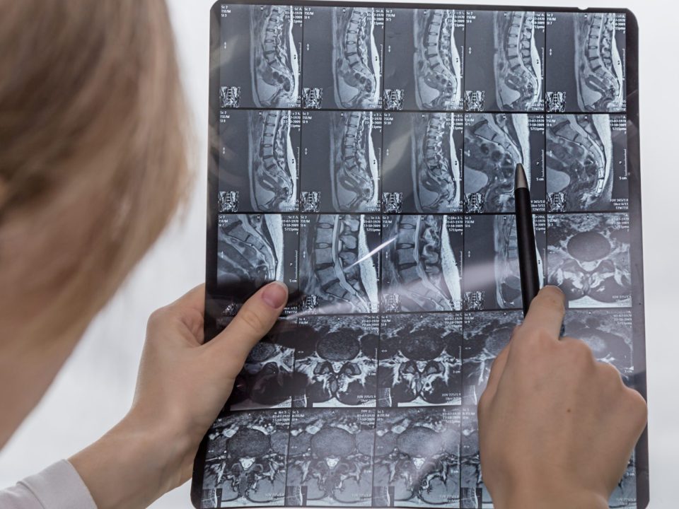 Traitement De La Hernie Discale À Bois-Des-Filion Clinique Tagmed Montréal Terrebonne