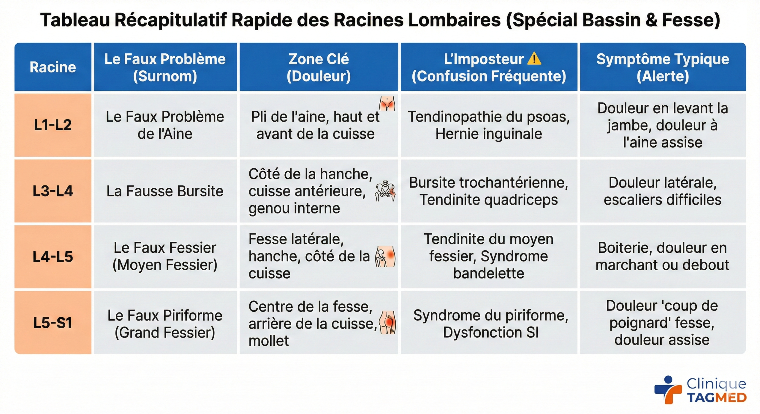 Tableau Récapitulatif Rapide des Racines Lombaires (Spécial Bassin)